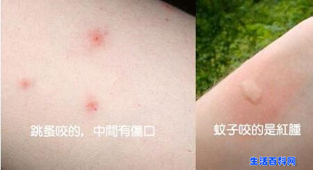 【圖文】跳蚤咬的症狀是什麼?被跳蚤咬的症狀圖片