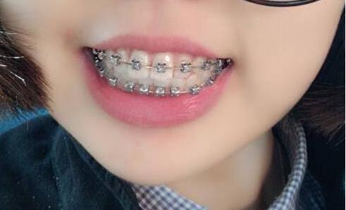 女生變漂亮的8個小常識!絕對好用