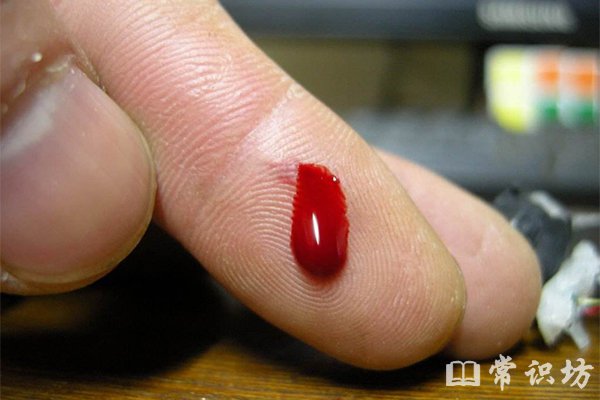 手部割傷正確處理:緊急止血、防止污染與損傷加重的關鍵步驟