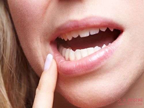 刷牙流血不一定是「去火」,小心可能是牙周病的前兆