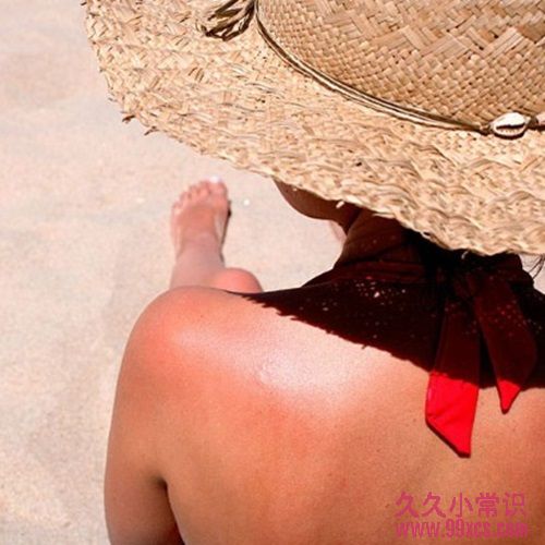 夏日防曬護膚必讀:避免燒傷與注意事項