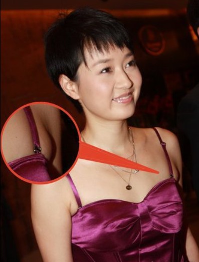 如何消除副乳及預防方法