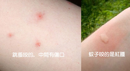 身上被跳蚤咬了怎麼辦？實用殺跳蚤方法與症狀處理全攻略
