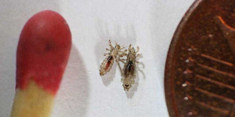 虱子怎麼去除？被虱子咬後症狀與處理方法全解析