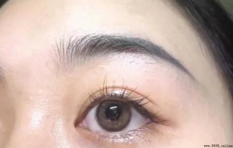 隐形眼镜滑落怎么办?解决方法全解析