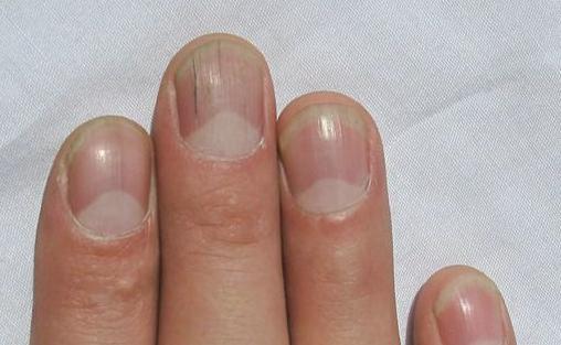 指甲形狀看個性與疾病：從形狀顏色解析健康與性格