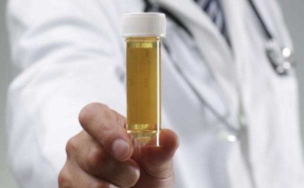 從尿液看健康：健康尿液的6大黃金標準