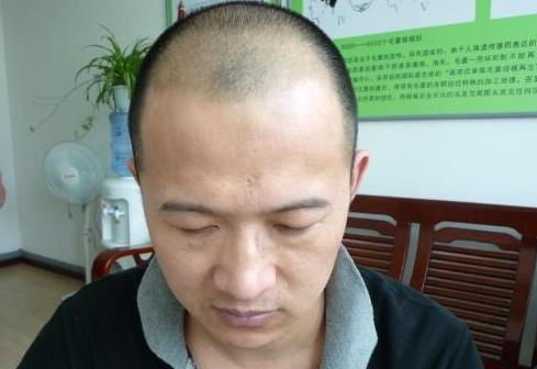 你不知道的事：身体这些部位越丑陋越健康