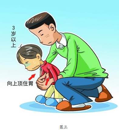 寶寶喉嚨卡異物急救指南:圖文示範如何迅速排出異物