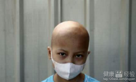 什麼病需要化療?四大化療手段與對應病症解析
