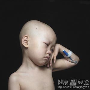 化療病人營養建議：3種有助恢復的食物
