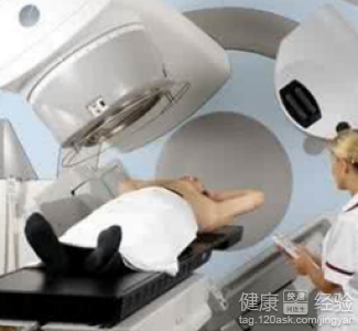 局部放療的兩大副作用與風險注意事項