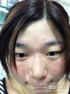 陰虛體質如何進行按摩調理