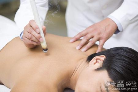 艾灸祛濕：有效穴位與方法指南