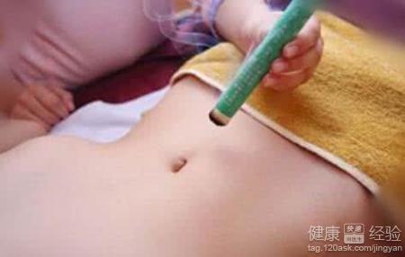 中醫艾灸：改善女性寒性體質的有效方法
