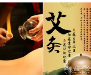 艾灸法改善女性体虚寒：方法与注意事項