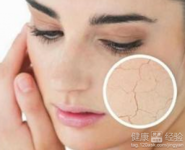五個壞習慣導致皮膚乾燥，中獲幾項
