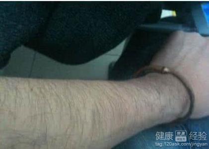 四肢皮膚粗糙、汗毛較長的改善方法