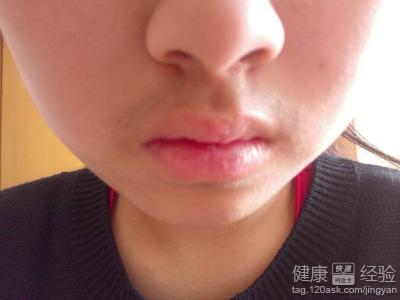 四肢皮膚粗糙、汗毛較長的改善方法