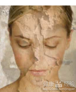 皮膚乾燥癢怎麼辦?解決方法與護膚建議