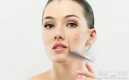 女性快速去痘印：3種簡單有效修復方法