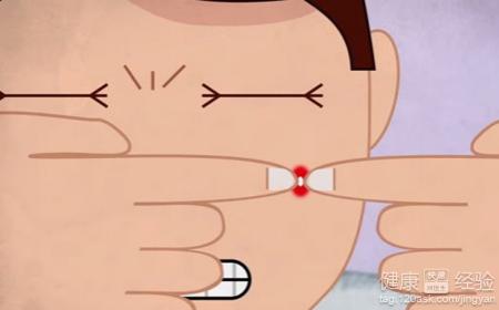 青春痘毛孔粗大改善指南：如何有效收缩毛孔