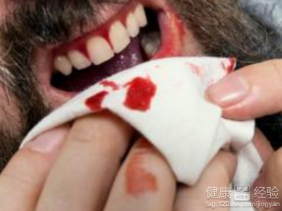 男性健康警示：7個出血部位不可忽視