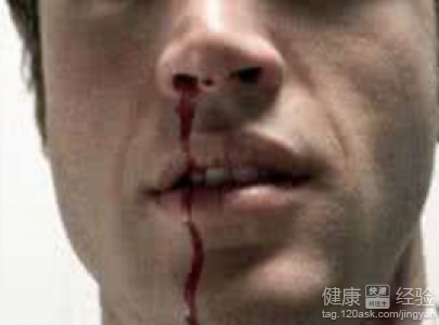 男性健康警示：7個出血部位不可忽視