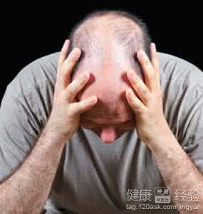 男性如何正确养生防脱发