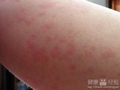 換季敏感肌保養常見誤區正確護理指南