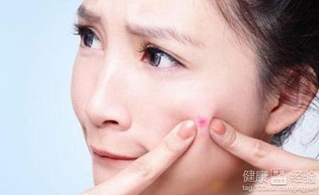 臙上長痘怎麼辦？快讓它好轉的食療小建議
