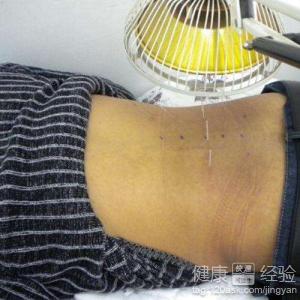 腰椎间盘突出日常保养、锻炼与饮食指南