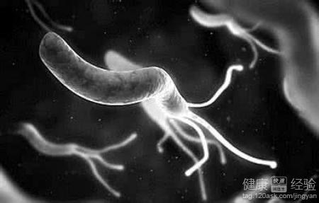 幽門螺旋桿菌陽性：飲食注意事項與生活建議