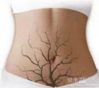 肠道健康饮食指南：四种食物助你清肠道
