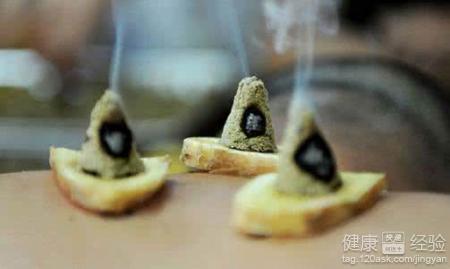 改善虚寒体质的艾灸穴位指南