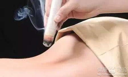 如何正確艾灸？艾灸的好處與操作步驟