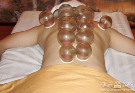 哪些人不適合拔罐減肥？七類人需警惕