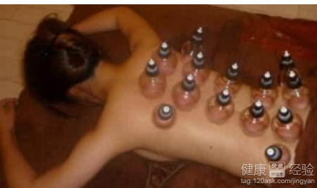 拔罐減肥會反彈嗎？正確減肥方法與後續對策