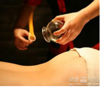 拔罐減肥是否有效？潛在副作用與正確方法解析