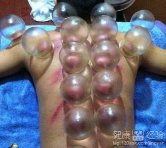 尚赫拔罐减肥指南:科学食谱与注意事项