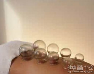 拔罐減肥能否飲酒？解析適量飲酒的注意事項
