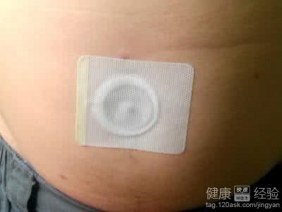 一炙瘦肚脐贴效果解析：功效与使用方法