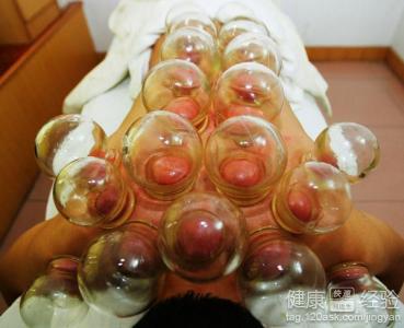 拔火罐減肥的注意事項與原理說明