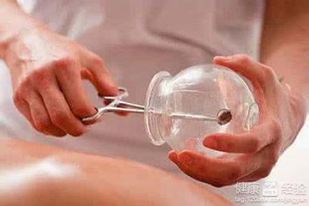 拔罐療法：常見的養生拔罐方法介紹