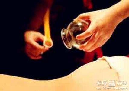 拔罐療法：常見的養生拔罐方法介紹