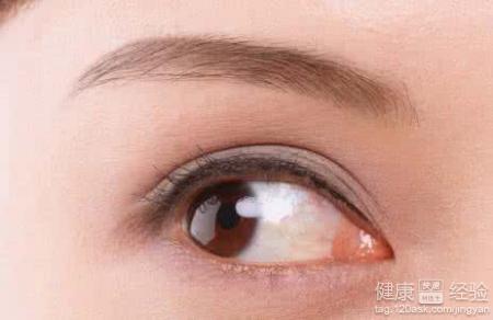 眼角突然變色對健康有影響嗎