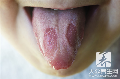 舌頭潰瘂忌口必看:7大飲食禁忌與注意事項