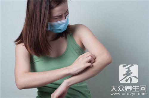 皮膚過敏可以喝茶嗎?飲茶注意事項與禁忌