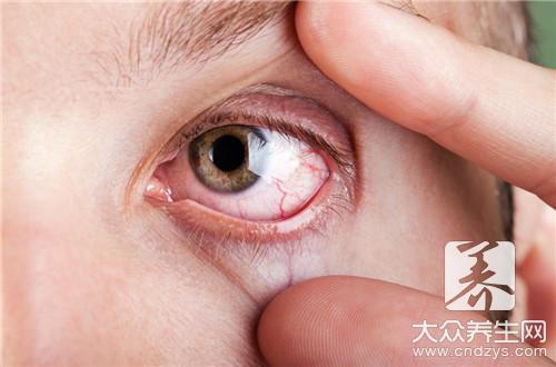大蒜虽好但有禁忌:六類人群應忌口