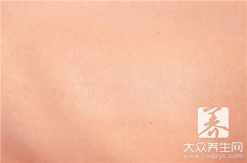 皮膚過敏飲食禁忌:避免過敏加重的關鍵注意事項